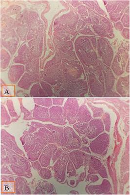 Effect of Different Levels of Multienzymes on Immune Response, Blood Hematology and Biochemistry, Antioxidants Status and Organs Histology of Broiler Chicks Fed Standard and Low-Density Diets